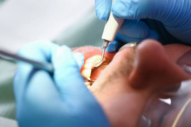 Best Emergency Treatment for Dental Infections or Abscesses in Selden, NY